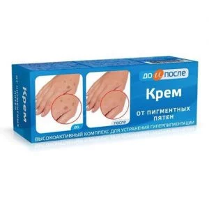Kem trị đồi mồi đốm nâu da tay Kpem Nga - 50ml