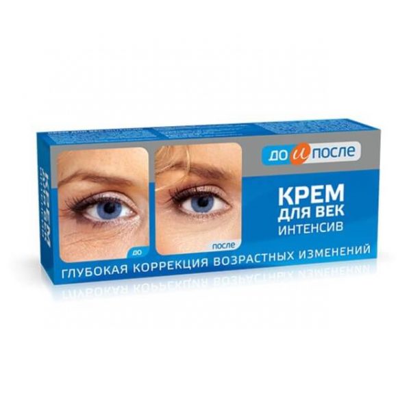 Kem xóa nếp nhăn vùng mắt Kpem của Nga - 30ml