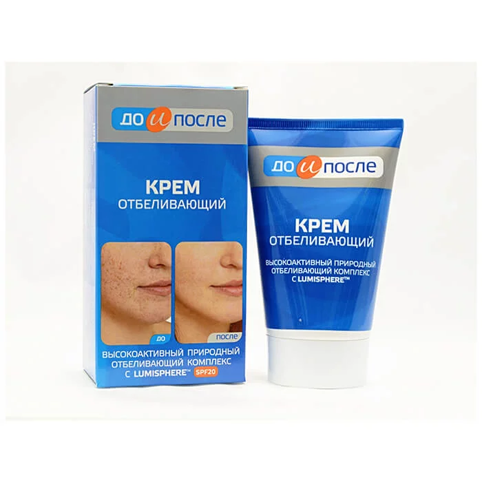 Kem trị nám Kpem của Nga - 100ml
