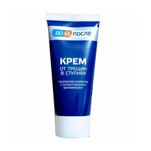 Kem trị nứt nẻ gót Kpem của Nga - 50ml