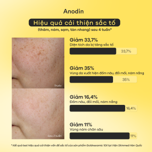Alternative view of Kem Dưỡng Anodin Goldnexamic 10x Cream: Mờ Thâm Nám, Sáng Da Đa Tầng
